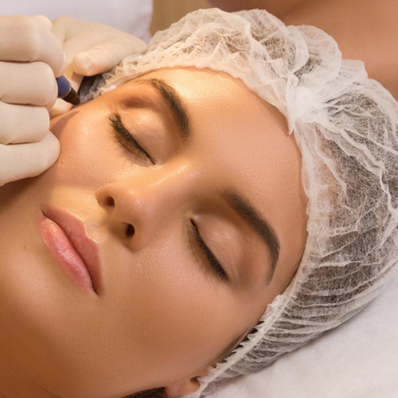 Шапочки одноразові «кульбабка», спанбонд , білий 100шт.